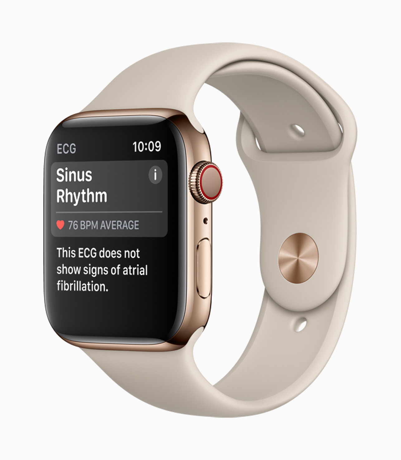 A results screen on Apple Watch Series 4 showing a Sinus Rhythm reading.