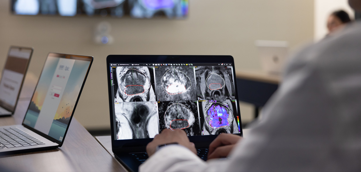 Une personne examinant des images médicales sur un MacBook. Deux autres MacBook sont ouverts à l’arrière-plan.